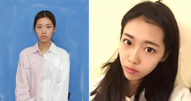 大媽臉變童顏少女臉，看我在廈門臉博士do了什么？