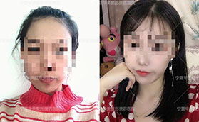 寧夏華美玻尿酸