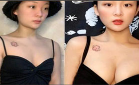 洛陽華美醫(yī)療美容醫(yī)院做假體隆胸怎么樣？看我就知道啦！