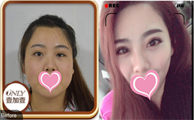 通過丁洪如眼綜合真人案例看北京壹加壹確實正規(guī)靠譜