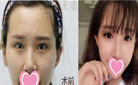 通過郭建玲眼綜合真人案例看北京京民是否正規(guī)靠譜？