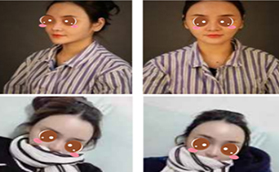 北京哪個(gè)醫(yī)生做脂肪修復(fù)好？愛多邦王紹國(guó)案例及價(jià)格分享