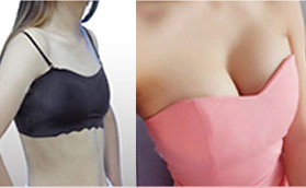 安徽維多利亞隆胸手術