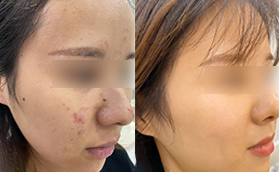 合肥美迪芬皮膚美容