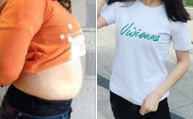 濟(jì)南藝星大腿/腰腹多位層環(huán)吸