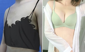 濟(jì)南韓氏整形醫(yī)院棉花糖豐胸對比圖組